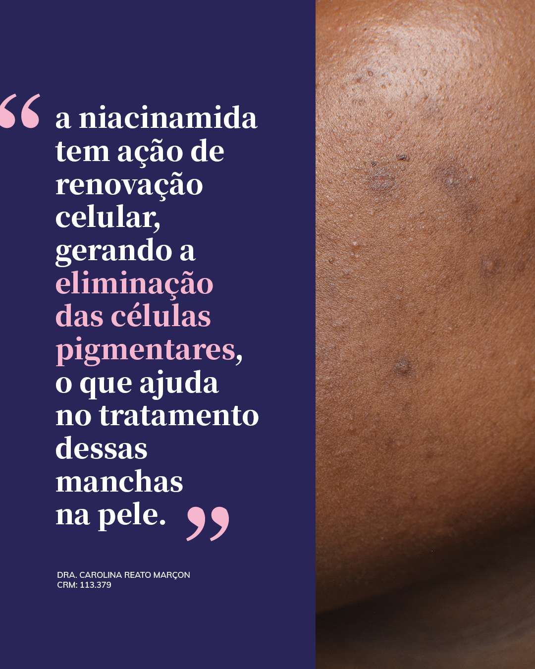 Explicação da ação da niacinamida