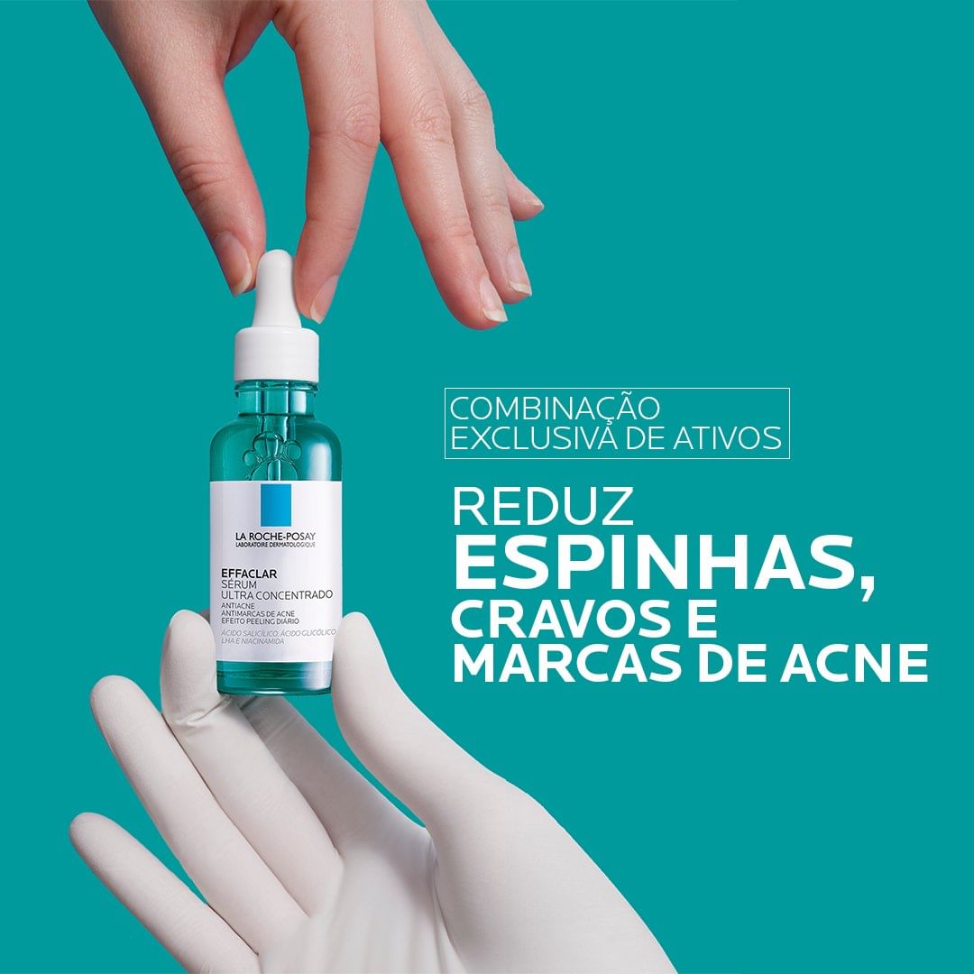 Sérum para reduzir as espinhas, cravos e marcas de acne